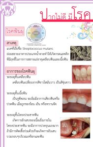 ปากไม่ดี มีโรค1