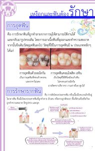 เหงือกและฟันต้องรักษา