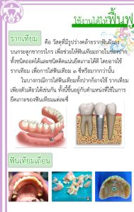 ใช้งานได้ ให้ฟื้นฟู2