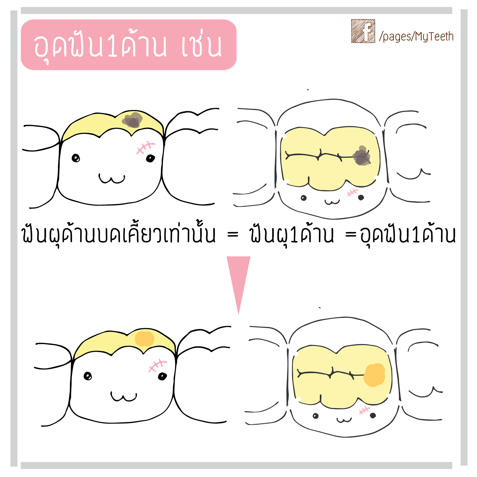 %e0%b8%94%e0%b9%89%e0%b8%b2%e0%b8%99%e0%b8%ad%e0%b8%b8%e0%b8%94%e0%b8%9f%e0%b8%b1%e0%b8%99-14-01