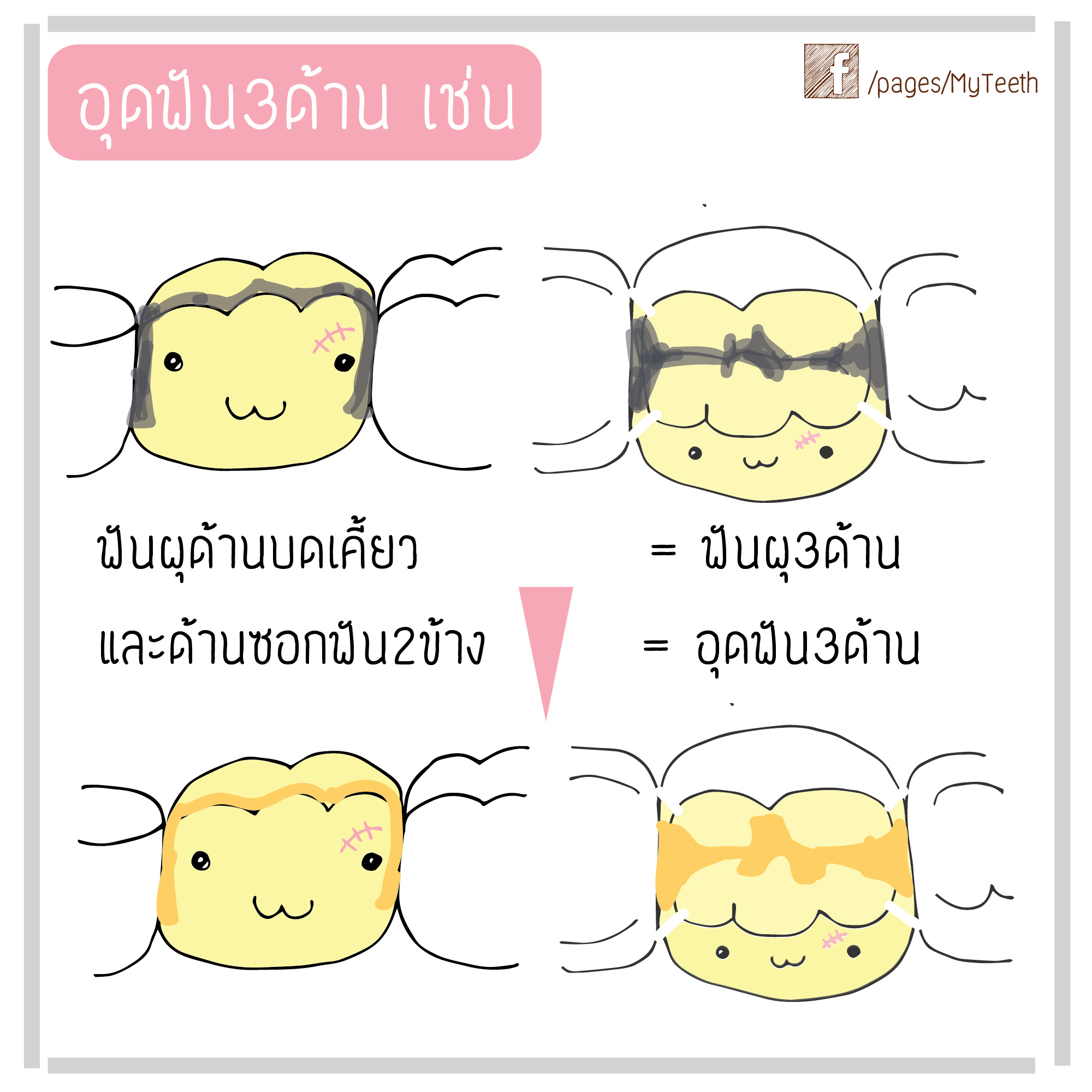 %e0%b8%94%e0%b9%89%e0%b8%b2%e0%b8%99%e0%b8%ad%e0%b8%b8%e0%b8%94%e0%b8%9f%e0%b8%b1%e0%b8%99-18-02-01