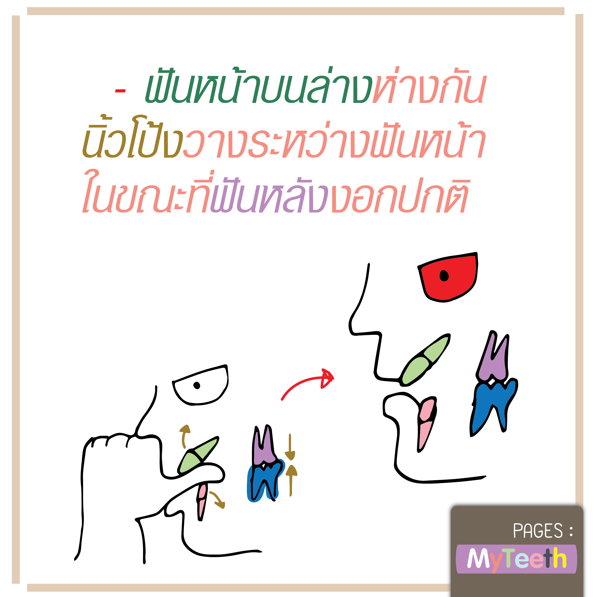 %e0%b8%99%e0%b8%b4%e0%b9%89%e0%b8%a710-01