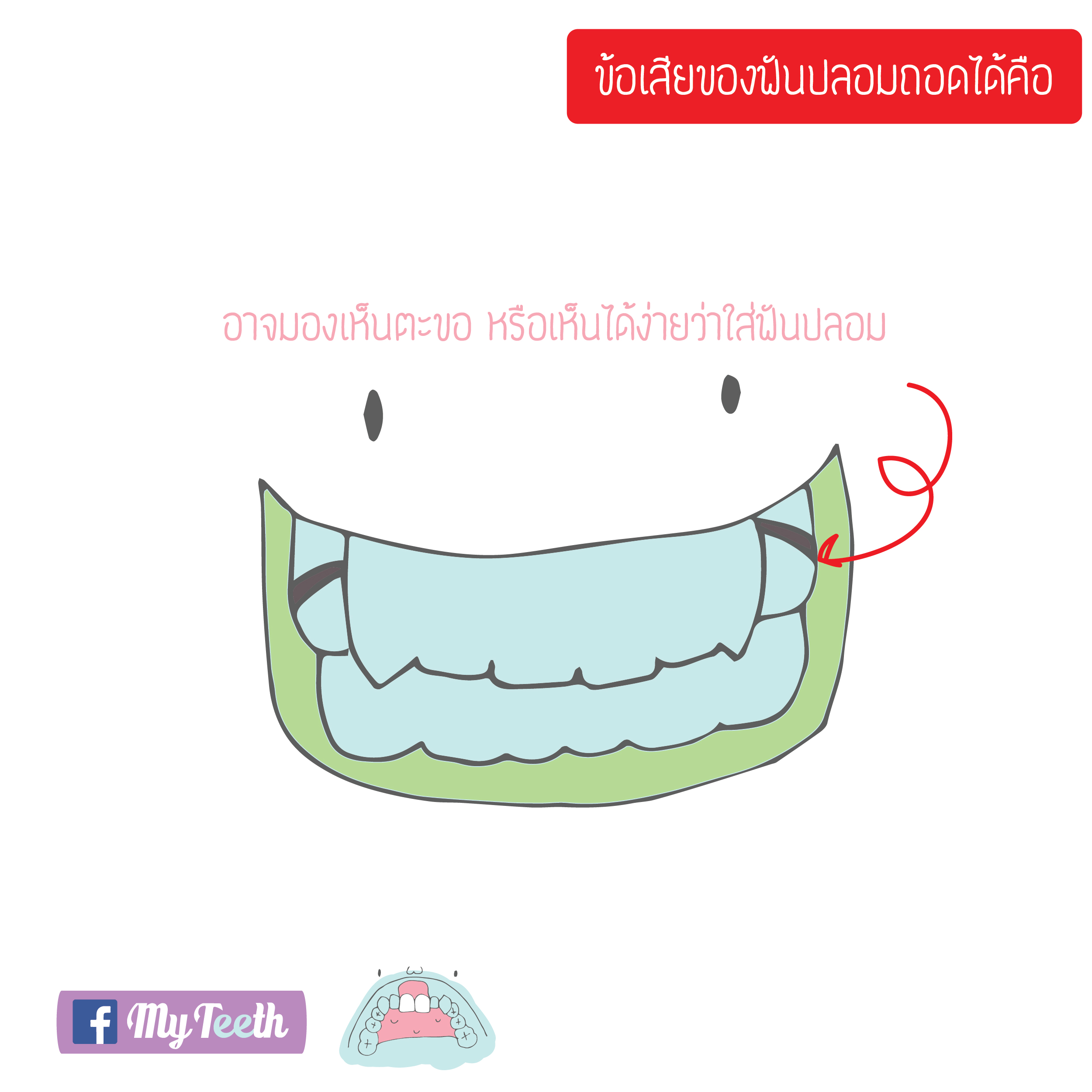 denture12-01