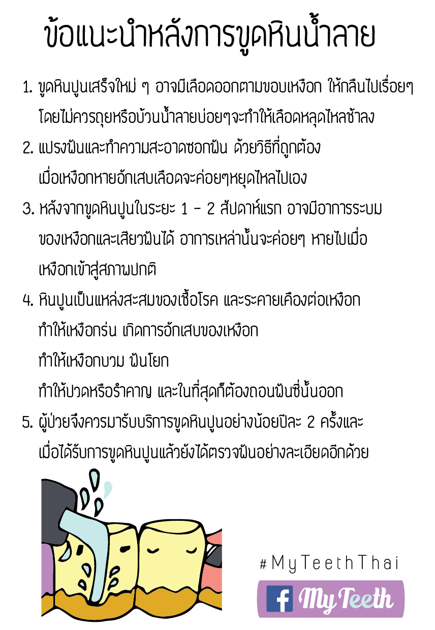 คำแนะนำขูดหินปูน-01