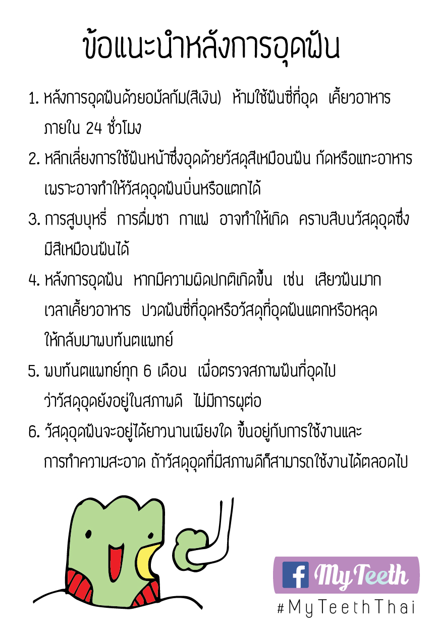 คำแนะนำอุดฟัน-01-01