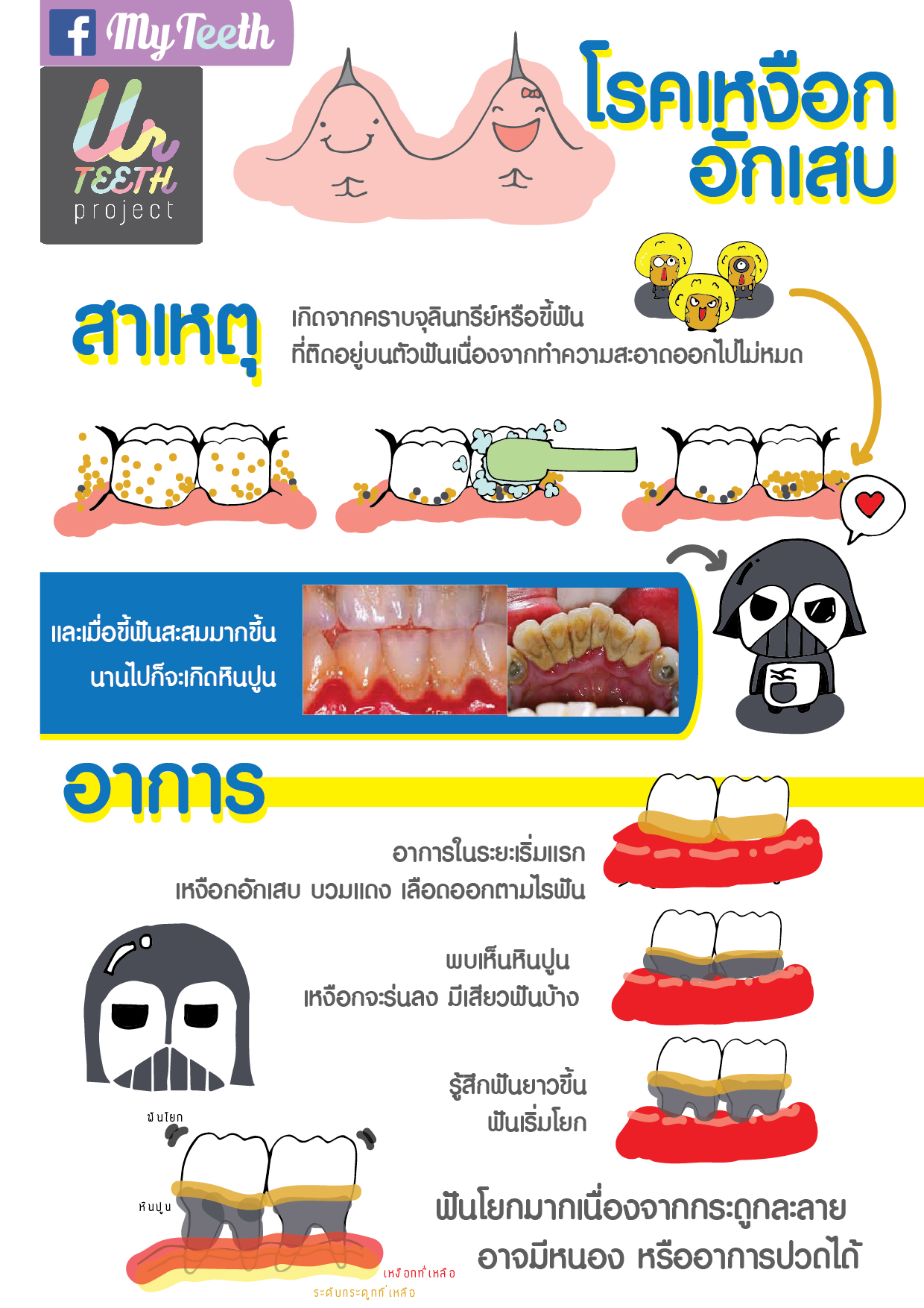 เหงือกอักเสบ-01