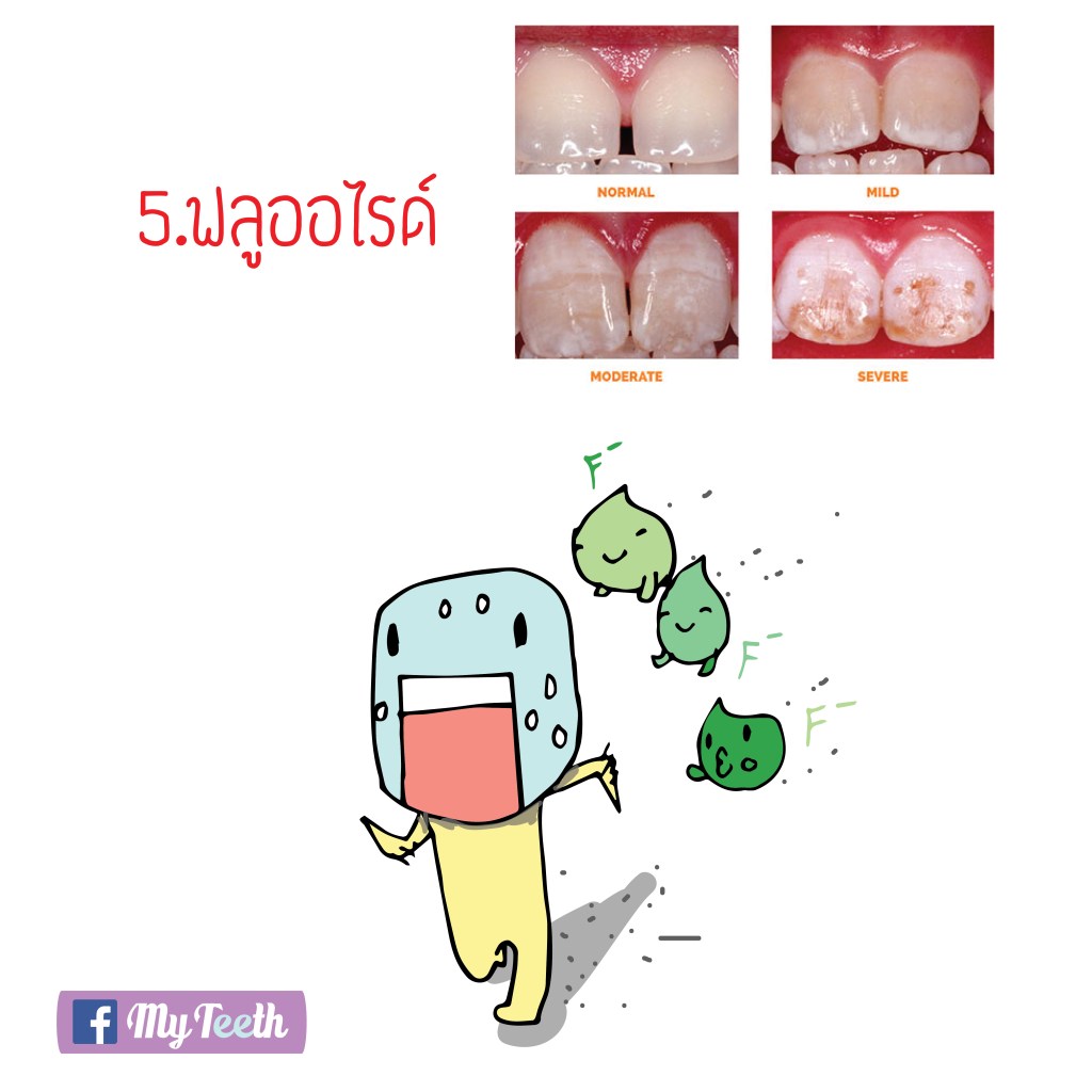 fluorosis