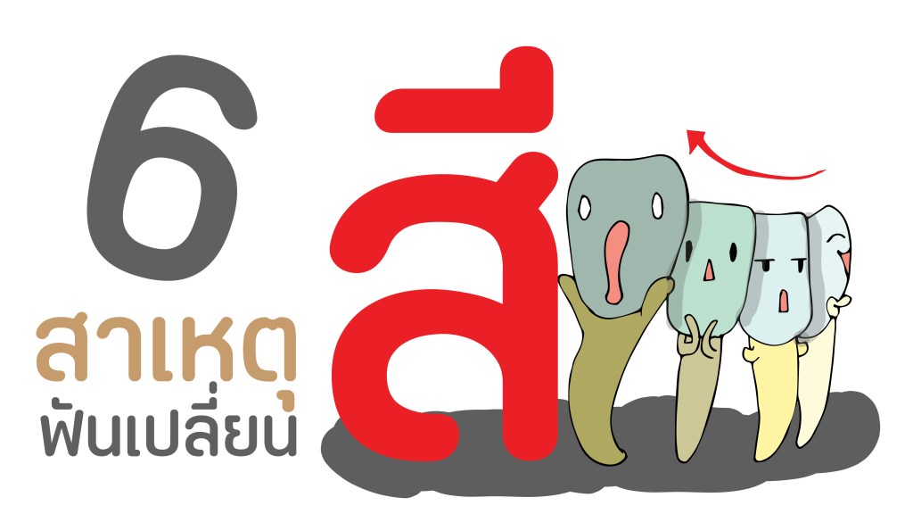 ฟันเปลี่ยนสี กับ สาเหตุทั้ง&nbsp;6